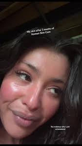 Achieve Clear and Glowing Skin with Korean Skincare