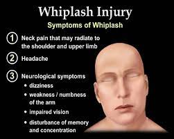 Whiplash Injury Animation Everything You Need To Know Dr Nabil Ebraheim M D Youtube Whiplash Injury Whiplash Whiplash Treatment