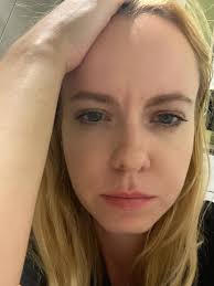 Good morning from Ukraine🫂🫂 Kyiv woke under shaheds last night. Air  alerts screaming through the dark, Explosions shaking the streets, But  somehow I slept Exhaustion finally won over fear. Buildings damaged. People