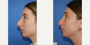 Ellen Hancock, MD, Board Eligible Plastic Surgeon