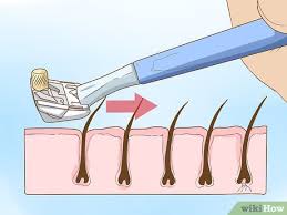 Soon after shaving and waxing armpit hair, you notice a pimple under the armpit which is reddish and read and find out the best essential oil for the tweezer using this method in how to get rid of ingrown. 4 Ways To Get Rid Of A Zit On Your Armpit Wikihow