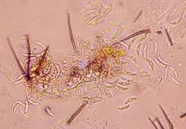 Infection usually develops from 1 to 7 days after exposure. çŸ³å·çœŒ ã‚¢ã‚ºã‚­ç‚­ç–½ç—…