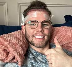 I'm A Celeb star Dean McCullough's four-figure hair transplant before  jungle adventure