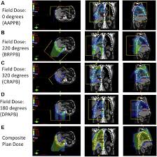 Check spelling or type a new query. Consensus Statement On Proton Therapy In Mesothelioma Practical Radiation Oncology