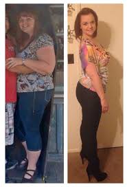 Pin By Maddison C On Before And After Gastric Sleeve Gastric Sleeve Best Cardio Workout Sleeves