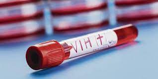 La Nación / “Conoce tu estado”, mensaje en el Día Mundial del SIDA