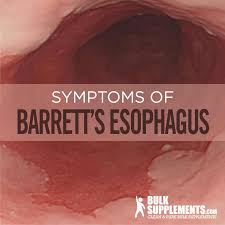 Barrett S Esophagus Symptoms Causes Treatment