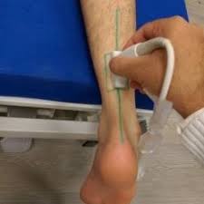The achilles tendon joins the calf muscles to the heel bone and runs down the back of the lower leg. Pdf Influence Of Bmi On Elastographic Strain Ratios Of Achilles Tendon