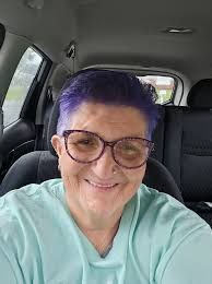 Wearing prosthetics is a personal choice