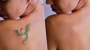 3,5,&7 day class for reno residents & or non locals and or 6month apprenticeship program for clark county residents. Jessica Raney Reno Nevada Professional Laser Tattoo Removal Youtube