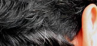 While most cases of white pubic hair are a result of the natural aging process, a few others may require medical attention. What Is The Reason For The Emergence Of White Hair When Young