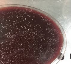 H pylori infection is c. Positive Culture Of Helicobacter Pylori On Brucella Blood Agar Media Download Scientific Diagram