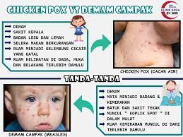 Chicken pox valtrex 500 mg from bigmountaindrugs. Assalammualaikum Dan Klinik Anda Kuala Selangor 24 Jam Facebook
