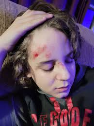 Truck blocks crosswalk, hits child while turning right