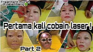 Karena kan mau enggak mau kena make up dan juga . Laser Black Doll Untuk Kulit Jerawat Part 2 Youtube