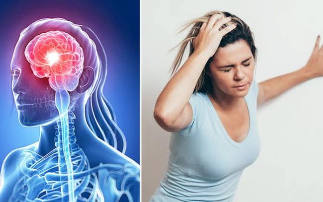 Cảnh báo nguy cơ đột quỵ ở người trẻ