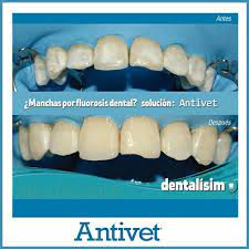 Nicedental Antivet Facebook Df treyd torgovaya kompaniya df treyd torgovaya kompaniya. nicedental antivet facebook