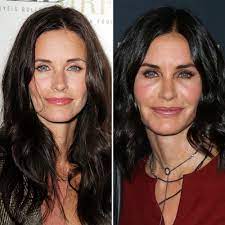 Gone are the days when you could spot somebody who had plastic surgery procedures with ease. Plastic Surgery Before And After Pics Courteney Cox Jwoww And More Celebrities