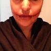 A glasgow smile is no laughing matter and is the infliction of an incision from the corner of the mouth to the ears and result in death or a scar in the shape of a smile Https Encrypted Tbn0 Gstatic Com Images Q Tbn And9gcq9ipq5eyn O9ww Adcfughpjhnmkukci4wula Zmxrowcypqa Usqp Cau