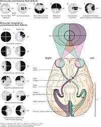 disorders of the eye harrisons principles of internal