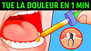 Elle se manifeste par de vives douleurs. 10 Manieres Pour Se Debarrasser D Un Mal De Dents En Une Minute Youtube