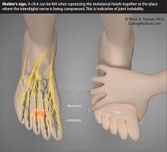 Morton S Neuroma Injections Caring Medical Florida