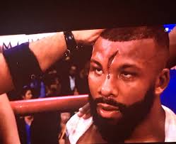 During the fight he suffered a hellacious cut down the center of his forehead. Badoujack Hashtag On Twitter