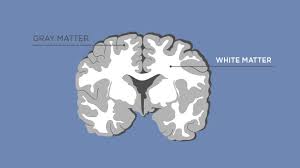 Matter is anything that has mass and takes up space. Gray Matter Vs White Matter Technology Networks