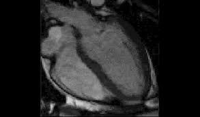 All ilive content is medically reviewed or fact checked to ensure as much factual accuracy as possible. Herz Mrt Cardio Mrt Radiologie Munchen