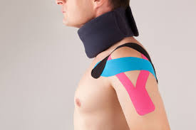 Diese Art Von Taping Wird Kinesiotape Genannt Schmerzen Lindern In Einigen Fallen Konnen Sie Den Muskel Auch Tonisieren Kinesio Tape Zur Stabilisierung Der Schulter Lizenzfreie Fotos Bilder Und Stock Fotografie Image 89937515