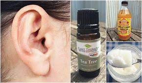 How To Get Rid Of Ear Wax 6 Home Remedies That Really Work Ear Wax Removal Ear Wax Ear Cleaning Wax