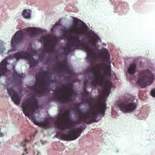 Imig recommends cytologic tests be supported by tumor tissue tests, imaging scans and other. Pdf Mesothelioma In Domestic Animals Cytological And Anatomopathological Aspects