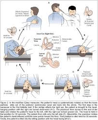 Inner ear problems are a menace to deal with, but then again they are not untreatable. 71 Bppv Ideas Vertigo Treatment Vertigo Vertigo Exercises
