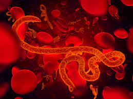 Ebola virus disease (ebola hemorrhagic fever) first appeared in 1976 with two concurrent outbreaks of acute viral hemorrhagic fever involving 284 cases (151 deaths 53%) centred in nzara, sudan (), and 318 cases (280 deaths 88%) in yambuku (near the ebola river), democratic republic of congo ().since these original cases, there have been approximately 20 other outbreaks occurring through to. Ebola Virus Disease Belgium Pdf Ppt Case Reports Symptoms Treatment