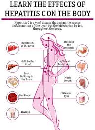 Pin On Health