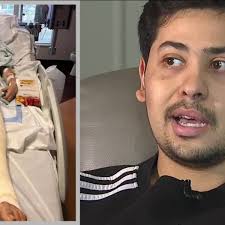 Denver man speaks out after suffering serious injuries in scooter  hit-and-run