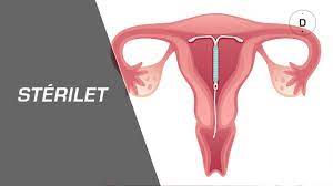 Arrêter de boire rime souvent avec une perte de poids importante. Sterilet Avantages Et Inconvenients Gynecologie Youtube