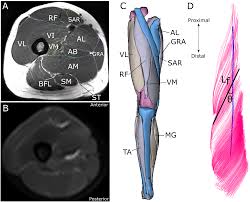 Back of leg muscle diagram. In Vivo Human Lower Limb Muscle Architecture Dataset Obtained Using Diffusion Tensor Imaging