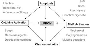 Image result for Chorioamnionitis