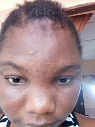 please what can I use to remove this white spots