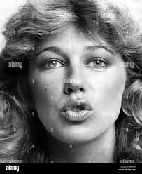 1980s surgery Black and White Stock Photos & Images