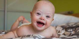 Karena jika bisa meningkatkan resiko terjadinya kelumpuhan. Bayi Down Syndrome Ini 15 Ciri Dan Tips Merawatnya