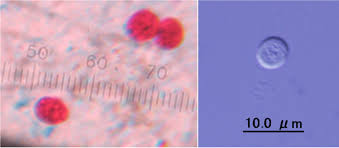 Most people who have healthy immune systems will recover. Cryptosporidium Troccap
