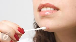 Cara menghilangkan flek hitam diwajah dapat menggunakan masker dari tomat, beras, kentang ataupun jeruk nipis. Cara Menghilangkan Flek Hitam Bekas Jerawat Dengan Bahan Alami Health Liputan6 Com