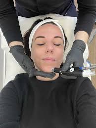 Mon avis sur mon soin HydraFacial au cabinet esthétique Rénecia