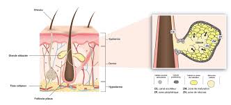 Image result for Sebaceous Gland
