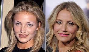 Cameron Diaz Before And After Plastic Surgery Cameron Diaz Plastic Surgery Cameron