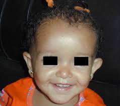 Nouveaux mécanismes moléculaires impliqués dans l'insensibilité à l'hormone  de croissance