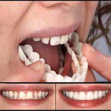 Abstracted Dental Implants Cost Wisdom Tooth Toothextraction Dentalhygienisttshirts Veneers Teeth Perfect Smile Smile Teeth