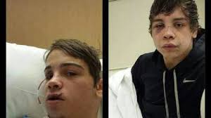 Petition · We want harsher penalties and charges in the beatings of Chase  and James Woolums. The group of teens who did this to them should be  charged and tried as adults. -